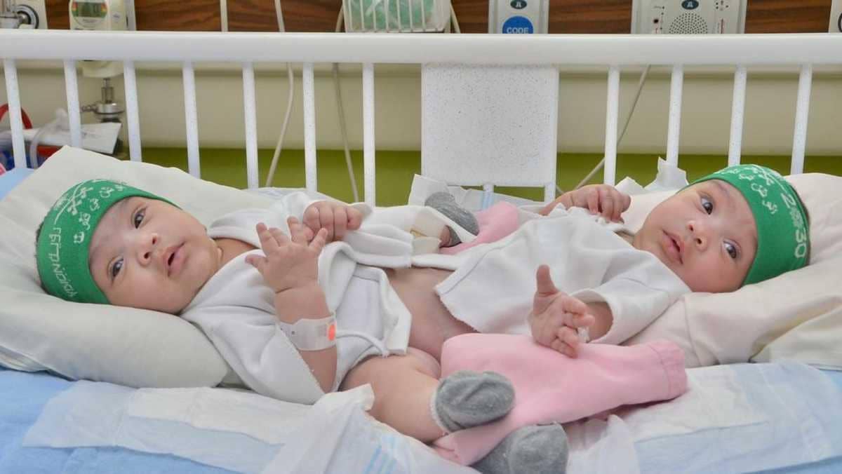  شيخة وشموخ.. نجاح الفصل النهائي للتوأم السعودي