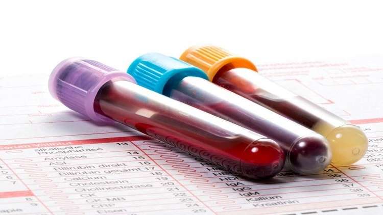 العلماء يطورون اختبار دم يشخص الإصابة بالسرطان في 10 دقائق فقط