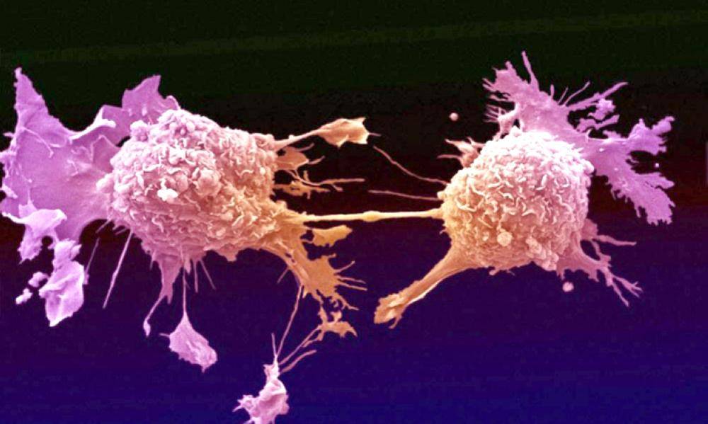 أخيراً.. علماء يكتشفون «أم الخلايا السرطانية»