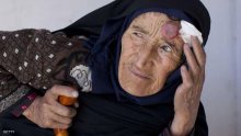 5 آلاف إصابة بوباء اللشمانيا في ليبيا خلال ستة شهور