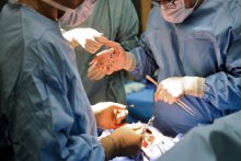 دراسة تثبت ارتباط السهر بتدهور القلب